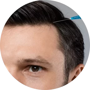AnyConv.com__mesotherapy-for-hair-young-man-getting-injections-2021-08-29-08-19-39-utc@2x